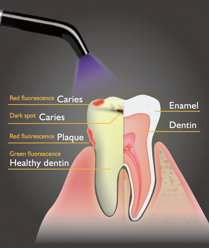 Đèn Quang Trùng Hợp Dentmate LEDEX WL-090+ – Công Nghệ LED Đa Chế Độ.