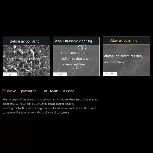 Máy thổi cát vệ sinh răng Woodpecker AP H