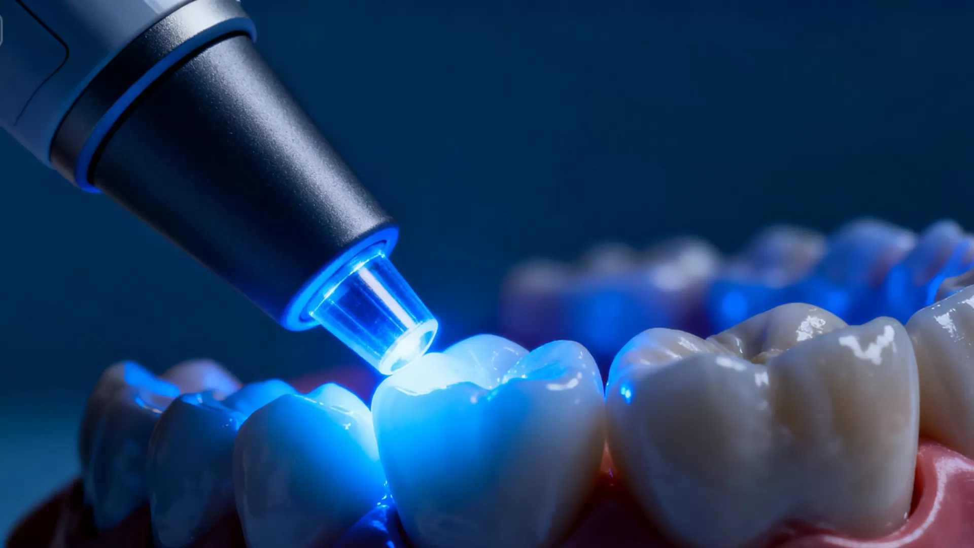 Thế nào là đèn trám răng loại tốt trong nha khoa hiện đại?